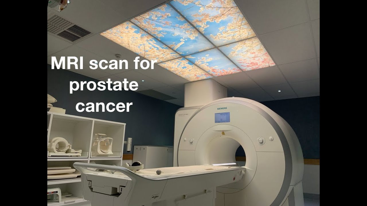 Prostate MRI for prostate cancer