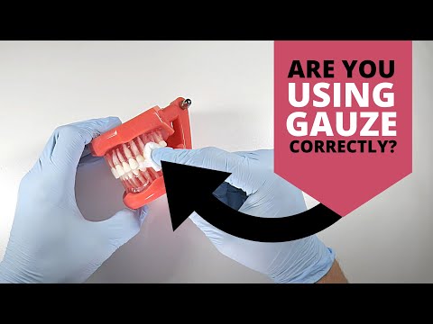 How To Place Gauze Properly | OnlineExodontia.com